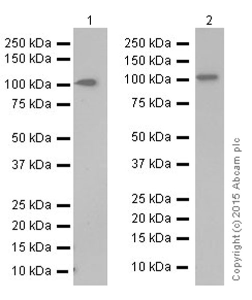 Western blot - Anti-Sarcomeric Alpha Actinin antibody [EP2529Y] (ab68167), expandable thumbnail