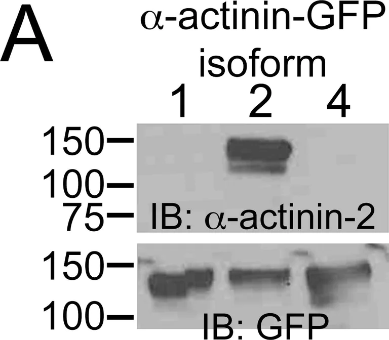 Western blot - Anti-Sarcomeric Alpha Actinin antibody [EP2529Y] (AB68167)