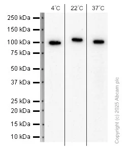 Western blot - Anti-Sarcomeric Alpha Actinin antibody [EP2529Y] (AB68167)