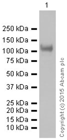 Western blot - Anti-Sarcomeric Alpha Actinin antibody [EP2529Y] (AB68167), expandable thumbnail