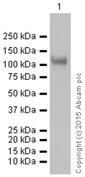 Western blot - Anti-Sarcomeric Alpha Actinin antibody [EP2529Y] (AB68167)
