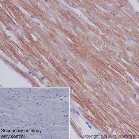 Immunohistochemistry (Formalin/PFA-fixed paraffin-embedded sections) - Anti-Sarcomeric Alpha Actinin antibody [EP2529Y] - BSA and Azide free (AB220817)
