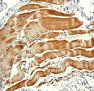 Immunohistochemistry (Formalin/PFA-fixed paraffin-embedded sections) - Anti-Sarcomeric Alpha Actinin antibody [EP2529Y] - BSA and Azide free (AB220817)