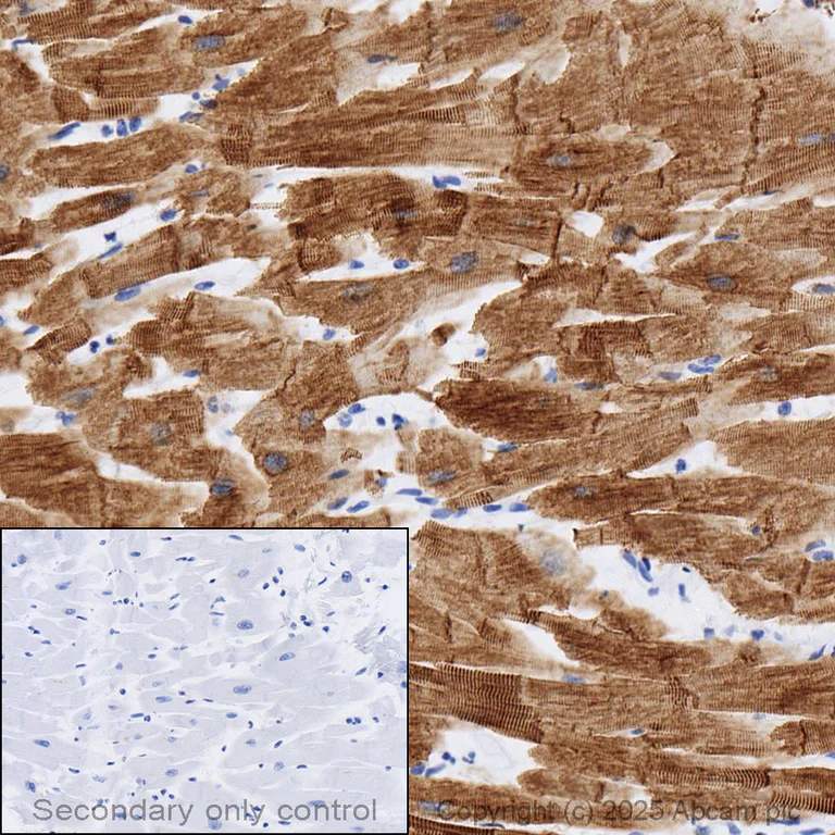 Immunohistochemistry (Formalin/PFA-fixed paraffin-embedded sections) - Anti-Sarcomeric Alpha Actinin antibody [EP2529Y] - BSA and Azide free (AB220817)