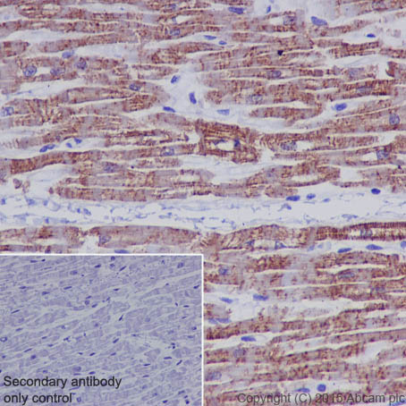 Immunohistochemistry (Formalin/PFA-fixed paraffin-embedded sections) - Anti-Sarcomeric Alpha Actinin antibody [EP2529Y] - BSA and Azide free (AB220817)