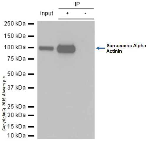 Immunoprecipitation - Anti-Sarcomeric Alpha Actinin antibody [EP2529Y] - BSA and Azide free (AB220817)