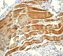 Immunohistochemistry (Formalin/PFA-fixed paraffin-embedded sections) - Anti-Sarcomeric Alpha Actinin antibody [EP2530Y] (AB68168)