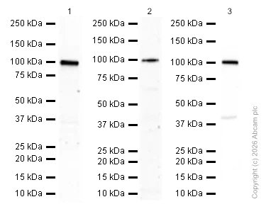 Western blot - Anti-Sarcomeric Alpha Actinin antibody [EP2530Y] (AB68168)