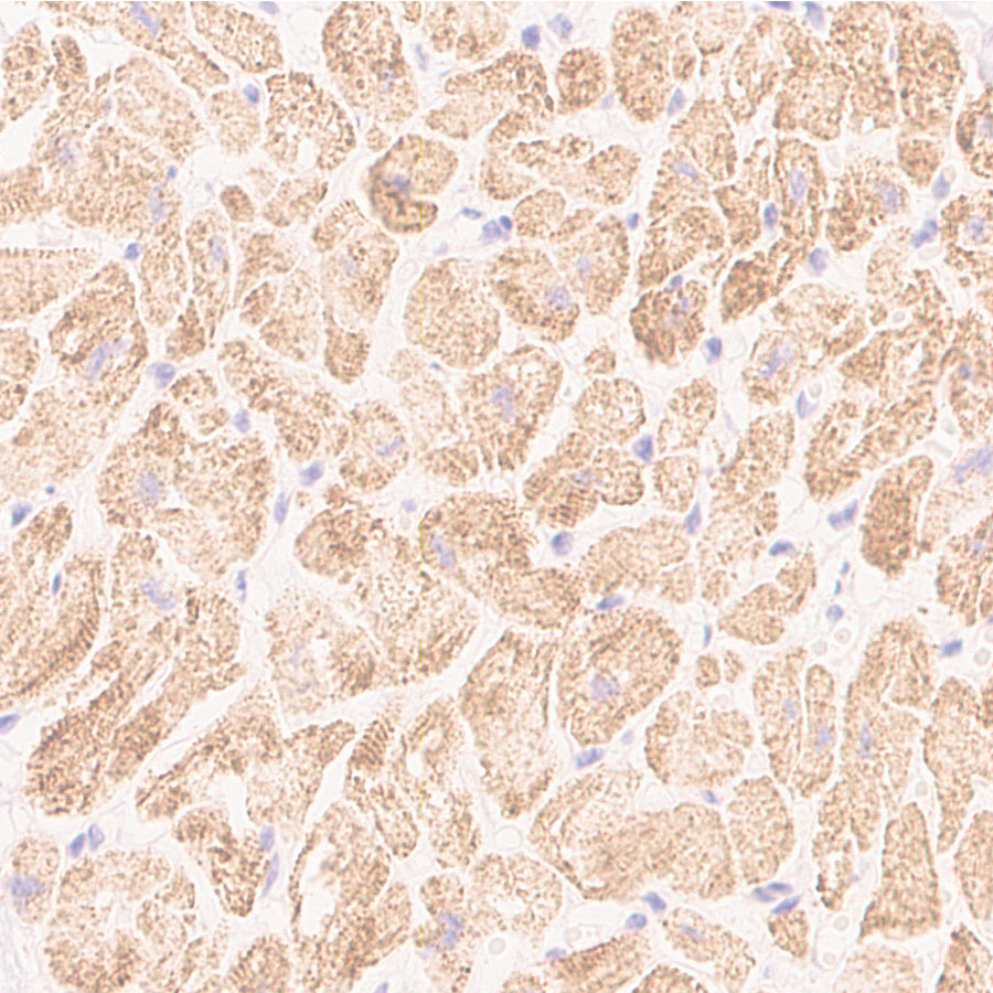Immunohistochemistry (Formalin/PFA-fixed paraffin-embedded sections) - Anti-Sarcomeric Alpha Actinin antibody [EP2530Y] - BSA and Azide free (AB247371)