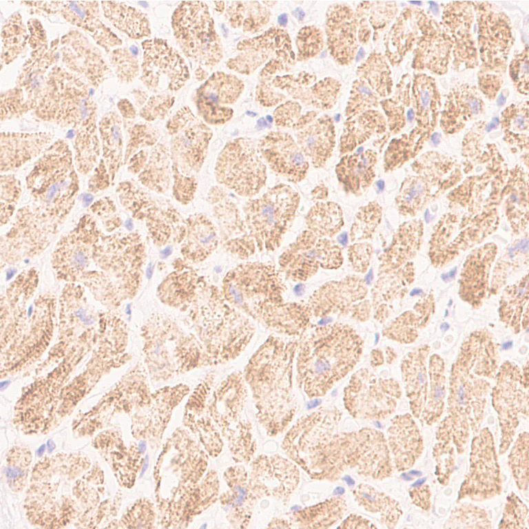 Immunohistochemistry (Formalin/PFA-fixed paraffin-embedded sections) - Anti-Sarcomeric Alpha Actinin antibody [EP2530Y] - BSA and Azide free (AB247371)