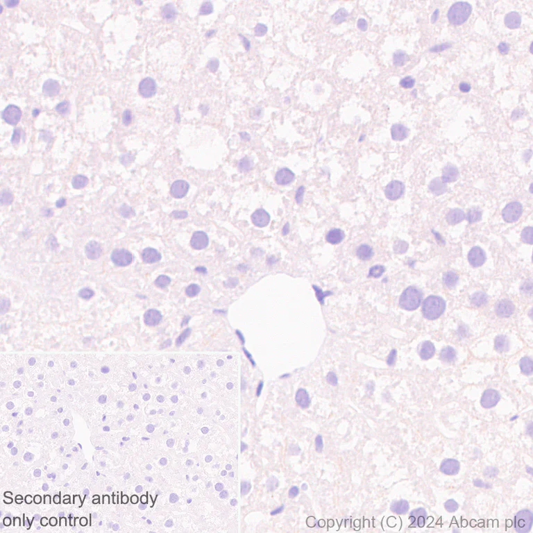 Immunohistochemistry (Formalin/PFA-fixed paraffin-embedded sections) - Anti-Sarcomeric Alpha Actinin antibody [EPR28776-83] (AB317695)
