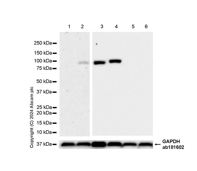Western blot - Anti-Sarcomeric Alpha Actinin antibody [EPR28776-83] (AB317695)