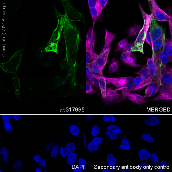 Immunocytochemistry/ Immunofluorescence - Anti-Sarcomeric Alpha Actinin antibody [EPR28776-83] - BSA and Azide free (ab317696), expandable thumbnail