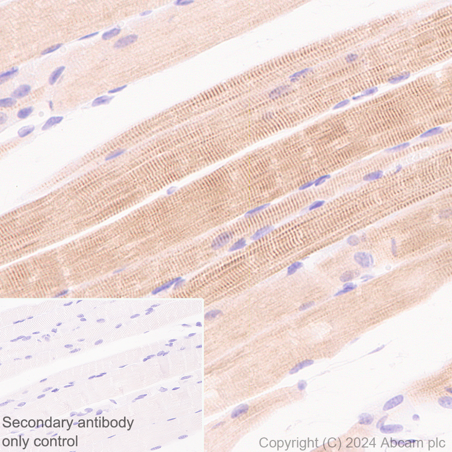 Immunohistochemistry (Formalin/PFA-fixed paraffin-embedded sections) - Anti-Sarcomeric Alpha Actinin antibody [EPR28776-83] - BSA and Azide free (ab317696), expandable thumbnail