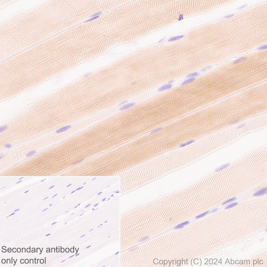 Immunohistochemistry (Formalin/PFA-fixed paraffin-embedded sections) - Anti-Sarcomeric Alpha Actinin antibody [EPR28776-83] - BSA and Azide free (ab317696), expandable thumbnail