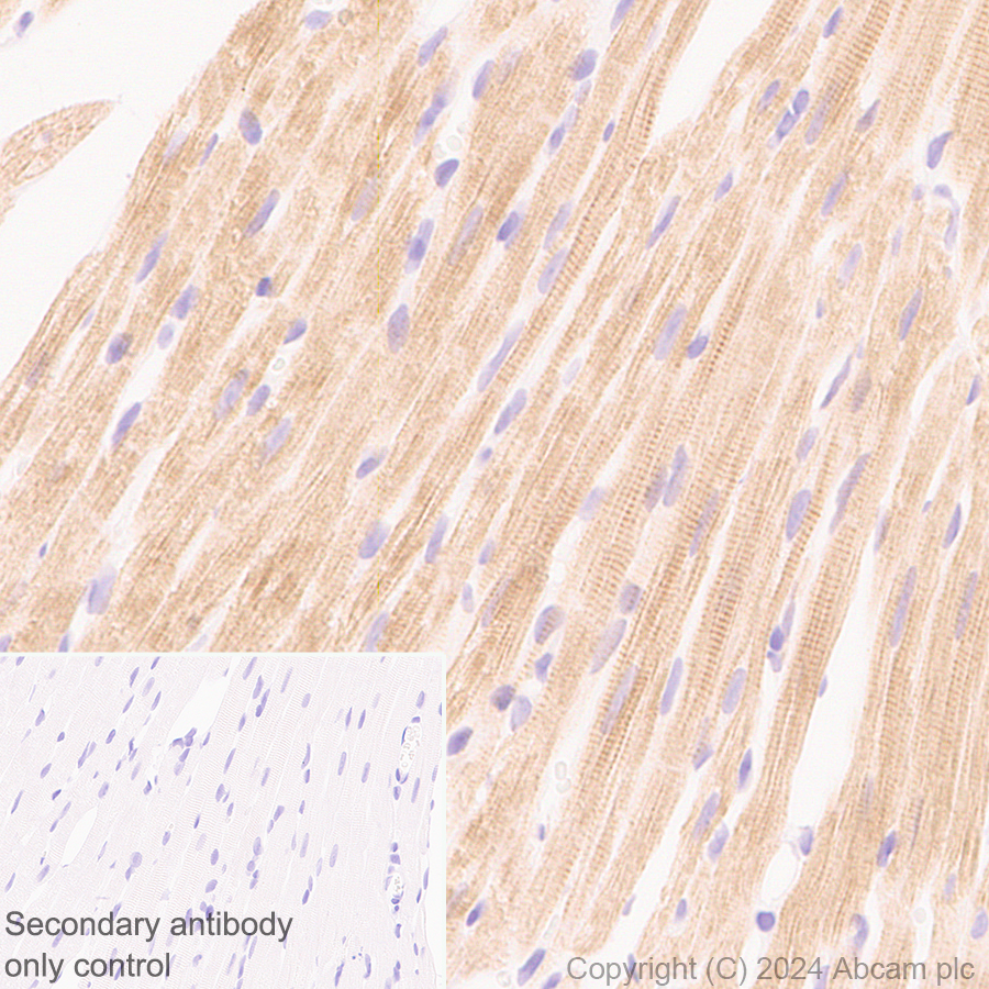 Immunohistochemistry (Formalin/PFA-fixed paraffin-embedded sections) - Anti-Sarcomeric Alpha Actinin antibody [EPR28776-83] - BSA and Azide free (ab317696), expandable thumbnail