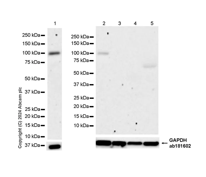 Western blot - Anti-Sarcomeric Alpha Actinin antibody [EPR28776-83] - BSA and Azide free (AB317696)