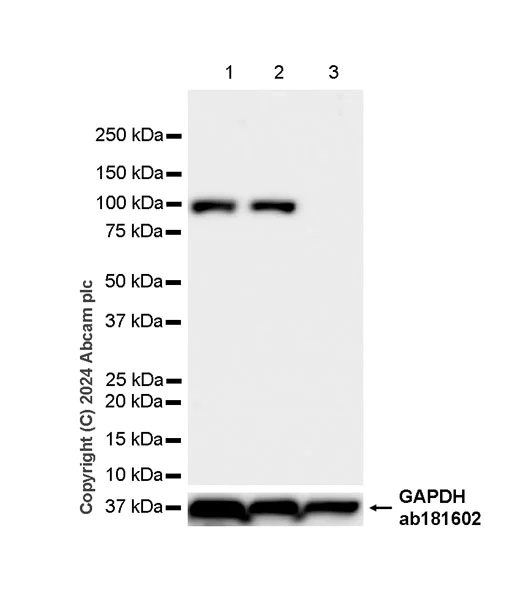 Western blot - Anti-Sarcomeric Alpha Actinin antibody [EPR28776-83] - BSA and Azide free (AB317696)