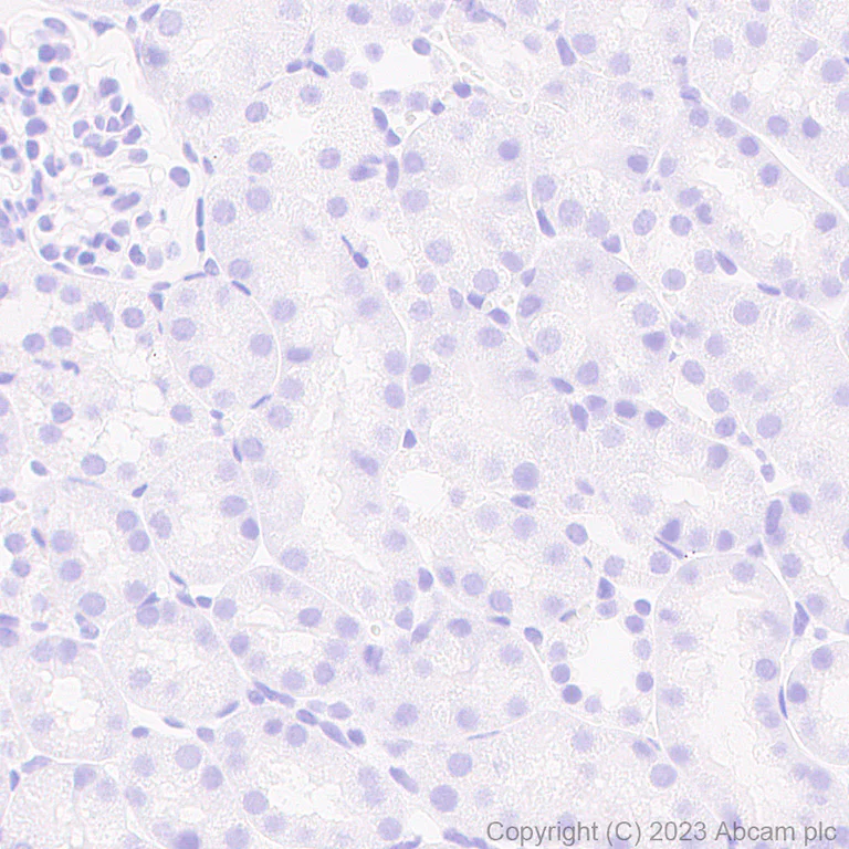 Immunohistochemistry (Formalin/PFA-fixed paraffin-embedded sections) - Anti-Sarcomeric Alpha Actinin antibody [RM1072] (AB314910)