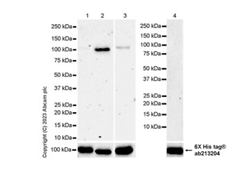 Western blot - Anti-Sarcomeric Alpha Actinin antibody [RM1072] (AB314910), expandable thumbnail