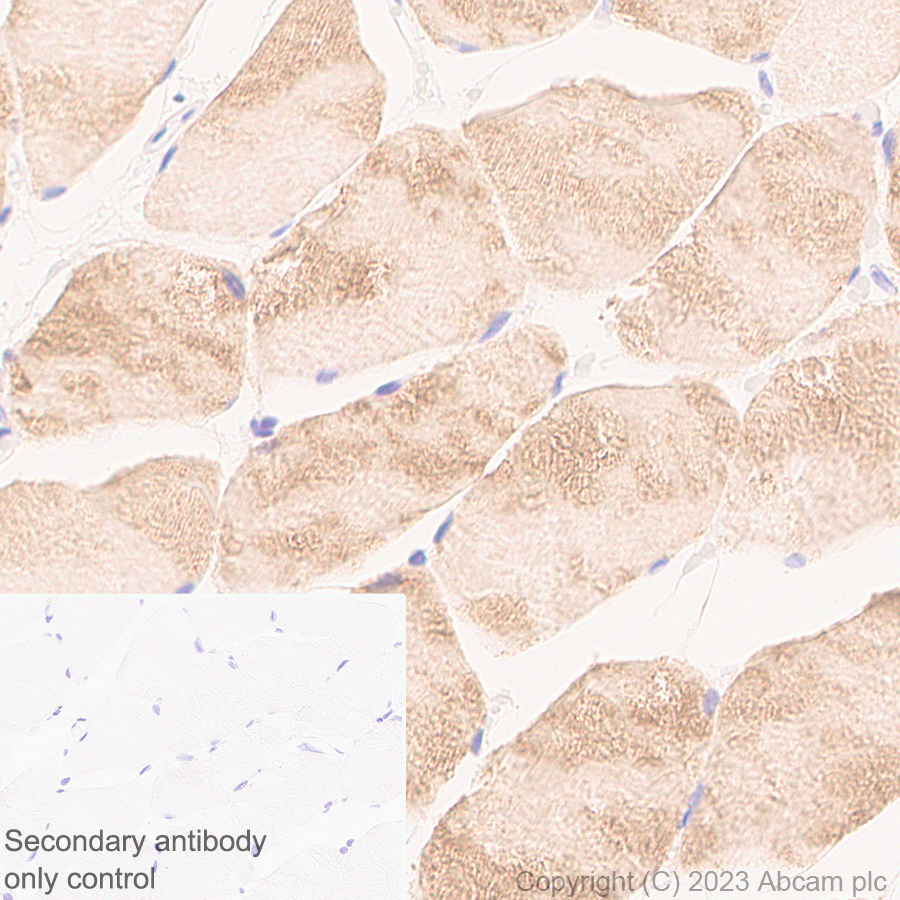 Immunohistochemistry (Formalin/PFA-fixed paraffin-embedded sections) - Anti-Sarcomeric Alpha Actinin antibody [RM1072] - BSA and Azide free (ab314911), expandable thumbnail