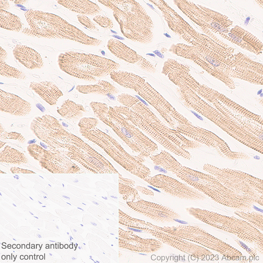 Immunohistochemistry (Formalin/PFA-fixed paraffin-embedded sections) - Anti-Sarcomeric Alpha Actinin antibody [RM1072] - BSA and Azide free (ab314911), expandable thumbnail