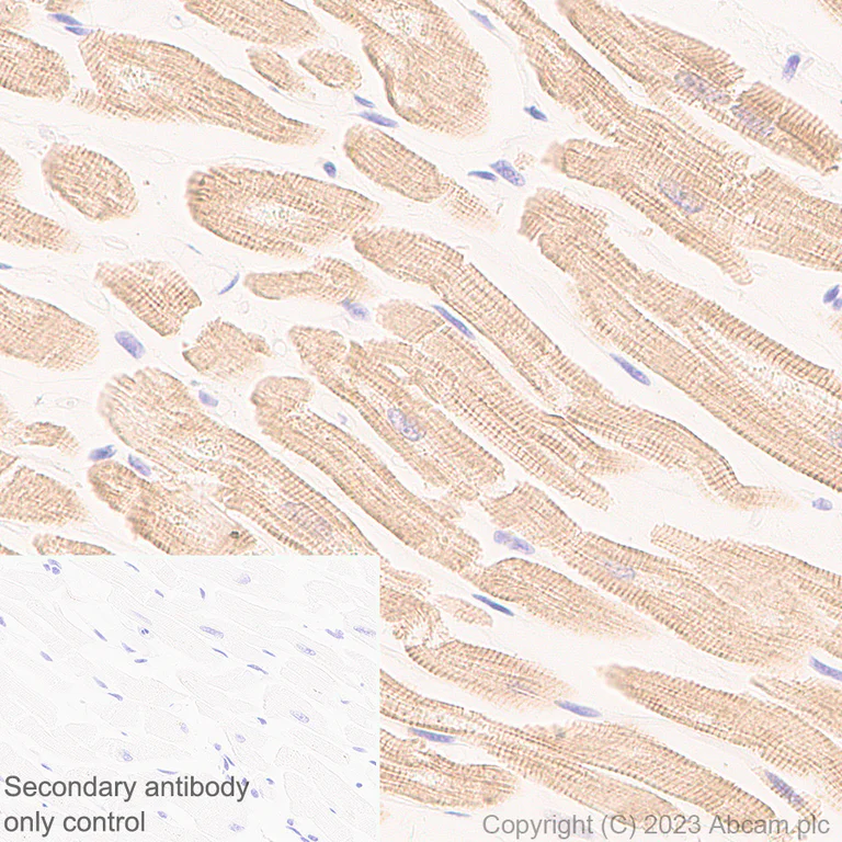 Immunohistochemistry (Formalin/PFA-fixed paraffin-embedded sections) - Anti-Sarcomeric Alpha Actinin antibody [RM1072] - BSA and Azide free (AB314911)