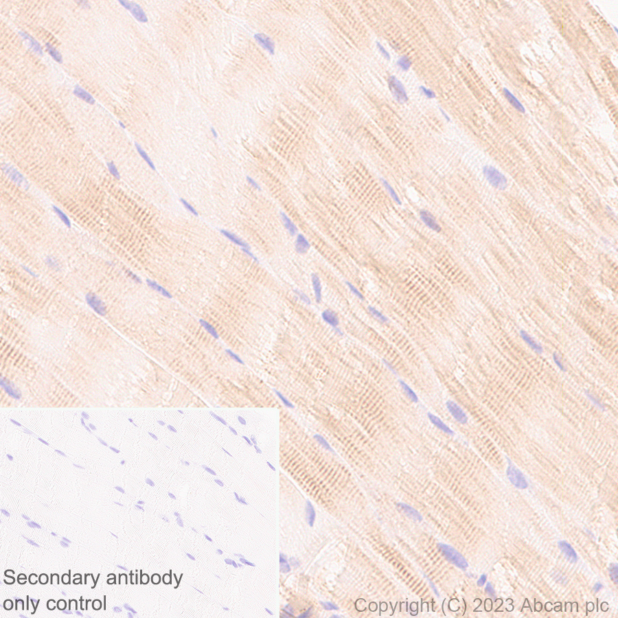 Immunohistochemistry (Formalin/PFA-fixed paraffin-embedded sections) - Anti-Sarcomeric Alpha Actinin antibody [RM1072] - BSA and Azide free (ab314911), expandable thumbnail