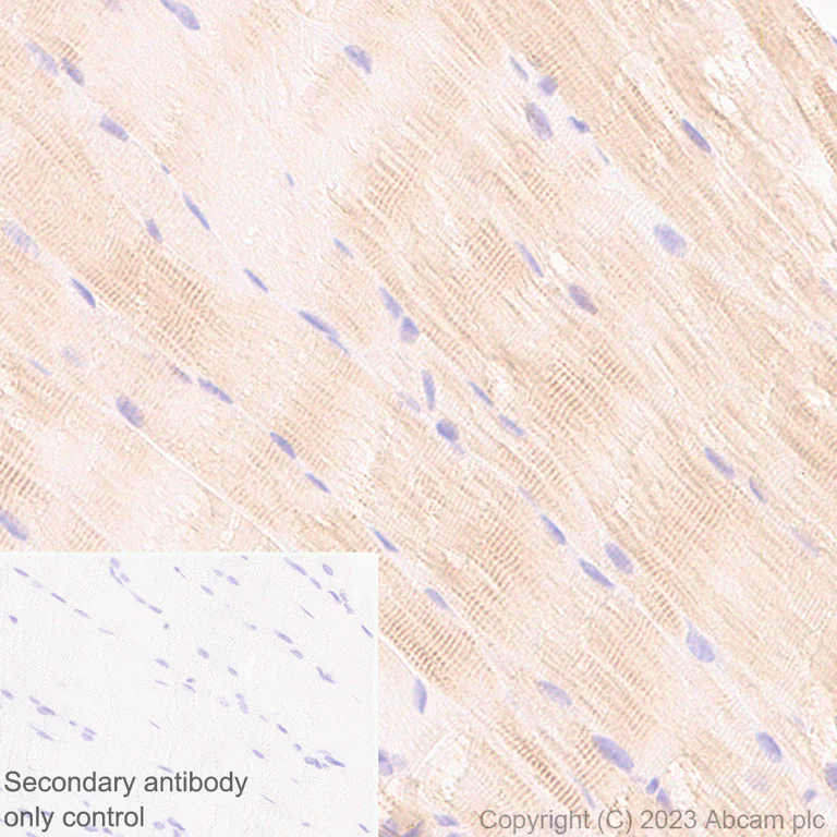 Immunohistochemistry (Formalin/PFA-fixed paraffin-embedded sections) - Anti-Sarcomeric Alpha Actinin antibody [RM1072] - BSA and Azide free (AB314911)