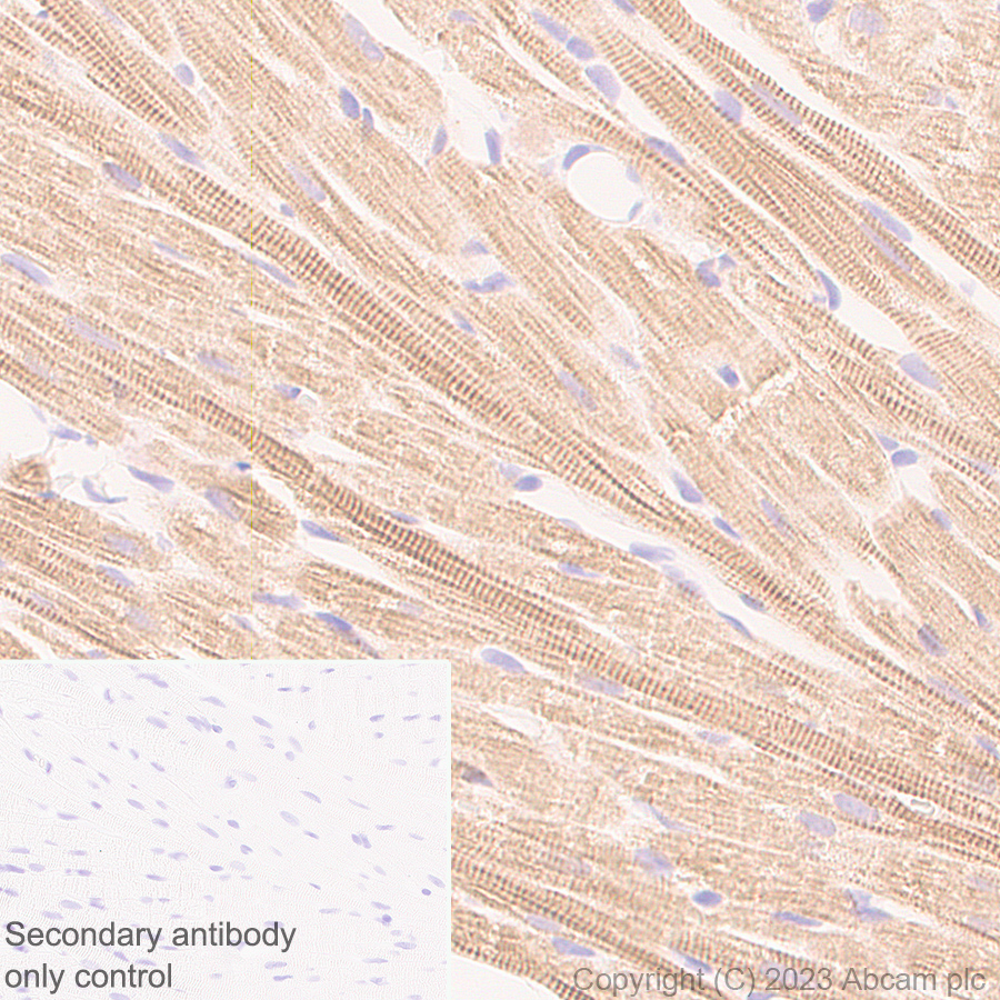 Immunohistochemistry (Formalin/PFA-fixed paraffin-embedded sections) - Anti-Sarcomeric Alpha Actinin antibody [RM1072] - BSA and Azide free (AB314911), expandable thumbnail