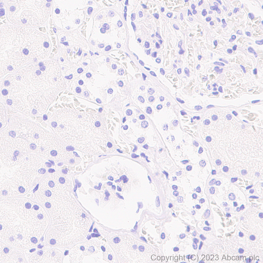 Immunohistochemistry (Formalin/PFA-fixed paraffin-embedded sections) - Anti-Sarcomeric Alpha Actinin antibody [RM1072] - BSA and Azide free (AB314911), expandable thumbnail