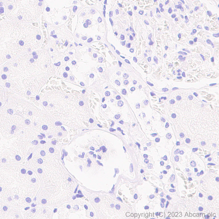 Immunohistochemistry (Formalin/PFA-fixed paraffin-embedded sections) - Anti-Sarcomeric Alpha Actinin antibody [RM1072] - BSA and Azide free (AB314911)