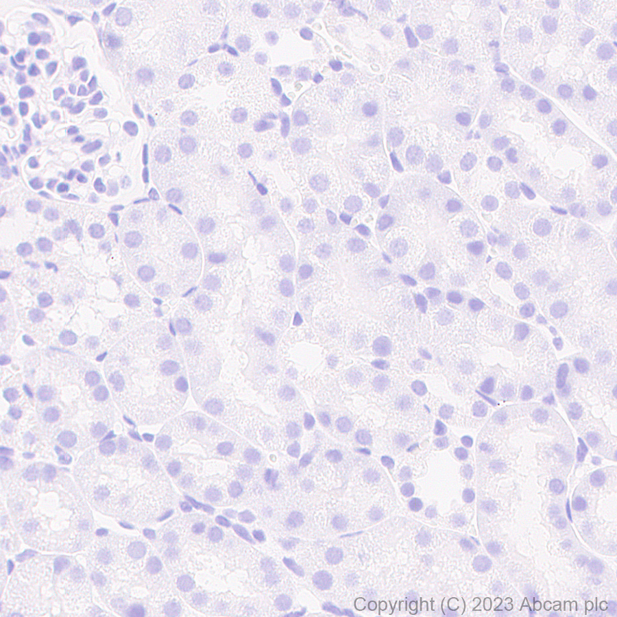 Immunohistochemistry (Formalin/PFA-fixed paraffin-embedded sections) - Anti-Sarcomeric Alpha Actinin antibody [RM1072] - BSA and Azide free (AB314911), expandable thumbnail