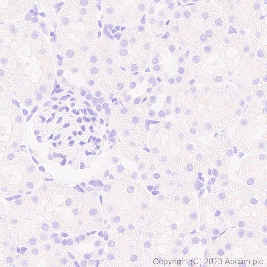 Immunohistochemistry (Formalin/PFA-fixed paraffin-embedded sections) - Anti-Sarcomeric Alpha Actinin antibody [RM1072] - BSA and Azide free (AB314911), expandable thumbnail