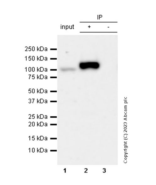 Immunoprecipitation - Anti-Sarcomeric Alpha Actinin antibody [RM1072] - BSA and Azide free (ab314911), expandable thumbnail