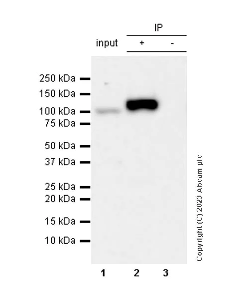 Immunoprecipitation - Anti-Sarcomeric Alpha Actinin antibody [RM1072] - BSA and Azide free (AB314911)