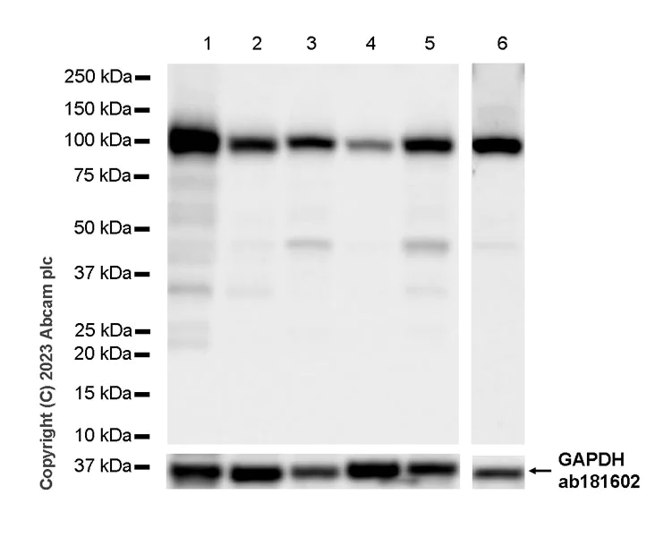 Western blot - Anti-Sarcomeric Alpha Actinin antibody [RM1072] - BSA and Azide free (AB314911)
