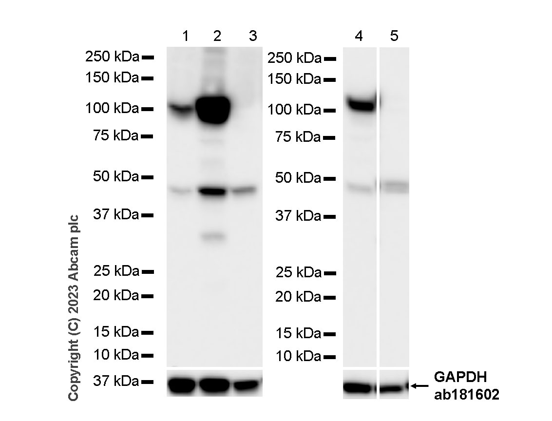 Western blot - Anti-Sarcomeric Alpha Actinin antibody [RM1072] - BSA and Azide free (ab314911), expandable thumbnail