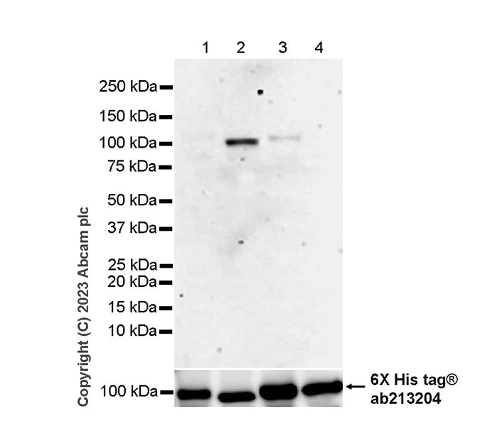 Western blot - Anti-Sarcomeric Alpha Actinin antibody [RM1072] - BSA and Azide free (AB314911)