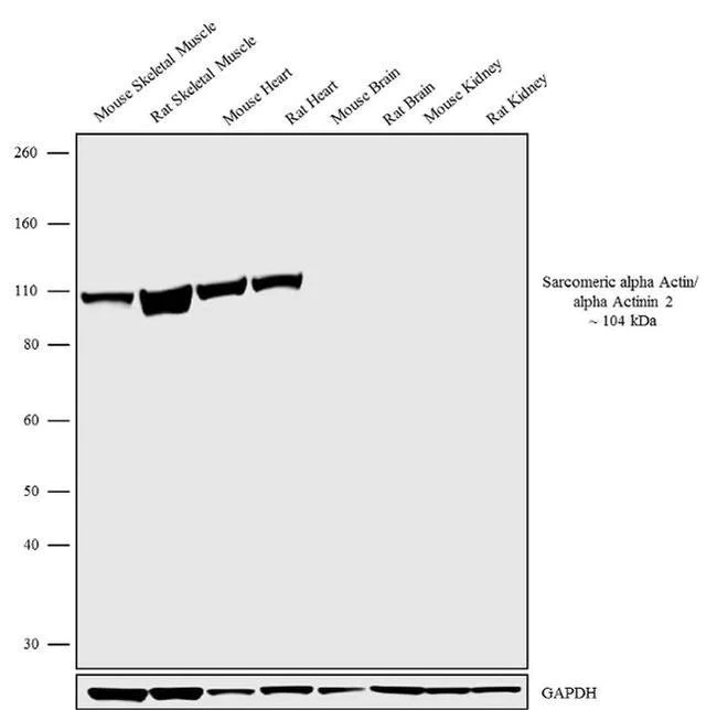 Western blot - Anti-Sarcomeric Alpha Actinin antibody [RP23040128] (AB313448)