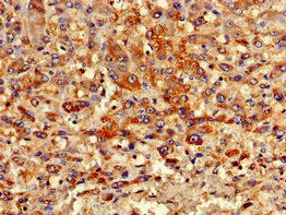 Immunohistochemistry (Formalin/PFA-fixed paraffin-embedded sections) - Anti-Sarcosine Oxidase/PSO antibody (AB223508)