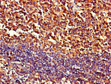 Immunohistochemistry (Formalin/PFA-fixed paraffin-embedded sections) - Anti-Sarcosine Oxidase/PSO antibody (AB223508), expandable thumbnail
