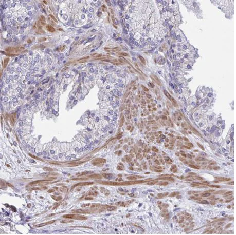Immunohistochemistry (Formalin/PFA-fixed paraffin-embedded sections) - Anti-SARDH antibody (AB188521)