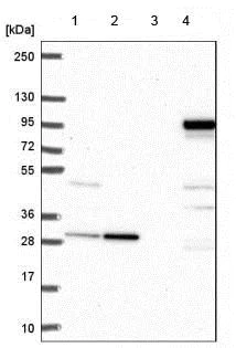Western blot - Anti-SARDH antibody (AB188521)