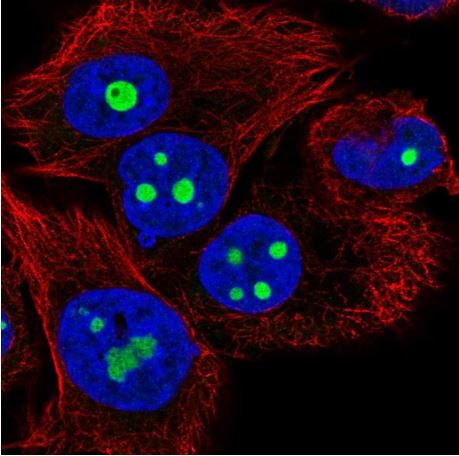 Immunocytochemistry/ Immunofluorescence - Anti-SARI antibody (AB204510)