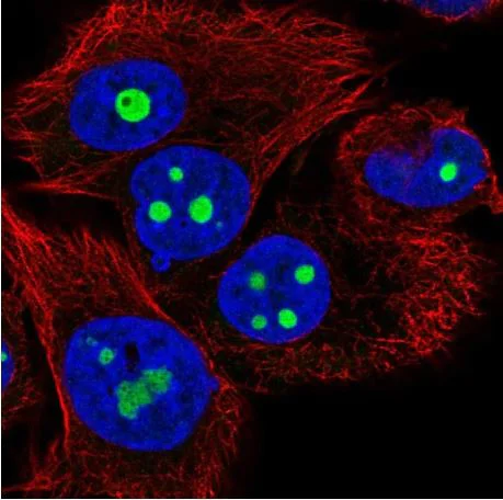 Immunocytochemistry/ Immunofluorescence - Anti-SARI antibody (AB204510)