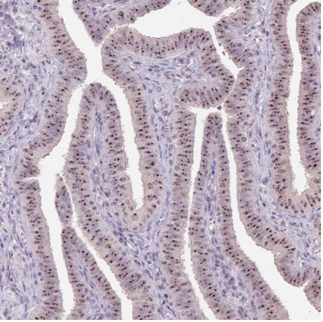 Immunohistochemistry (Formalin/PFA-fixed paraffin-embedded sections) - Anti-SARI antibody (AB204510)
