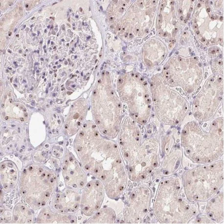 Immunohistochemistry (Formalin/PFA-fixed paraffin-embedded sections) - Anti-SARI antibody (AB204510)