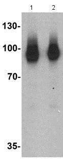 Western blot - Anti-SARM antibody (AB176277)