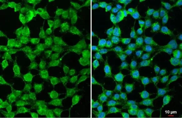 Immunocytochemistry/ Immunofluorescence - Anti-SARM antibody (AB226930)